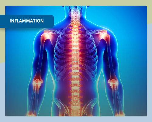 Low-Grade Inflammation_ Causes, Effects, and Interventions