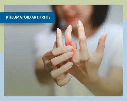 rheumatoid arthritis - Innerstrong Fitness